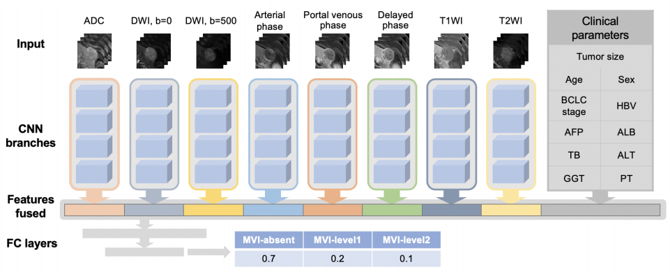 基于多模态影像的肝癌智能诊断技术研究与系统开发